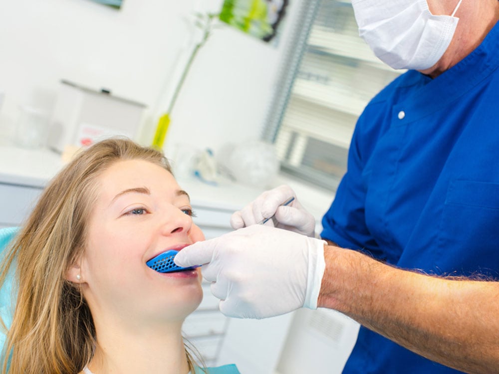 dental sealants in sherwood park