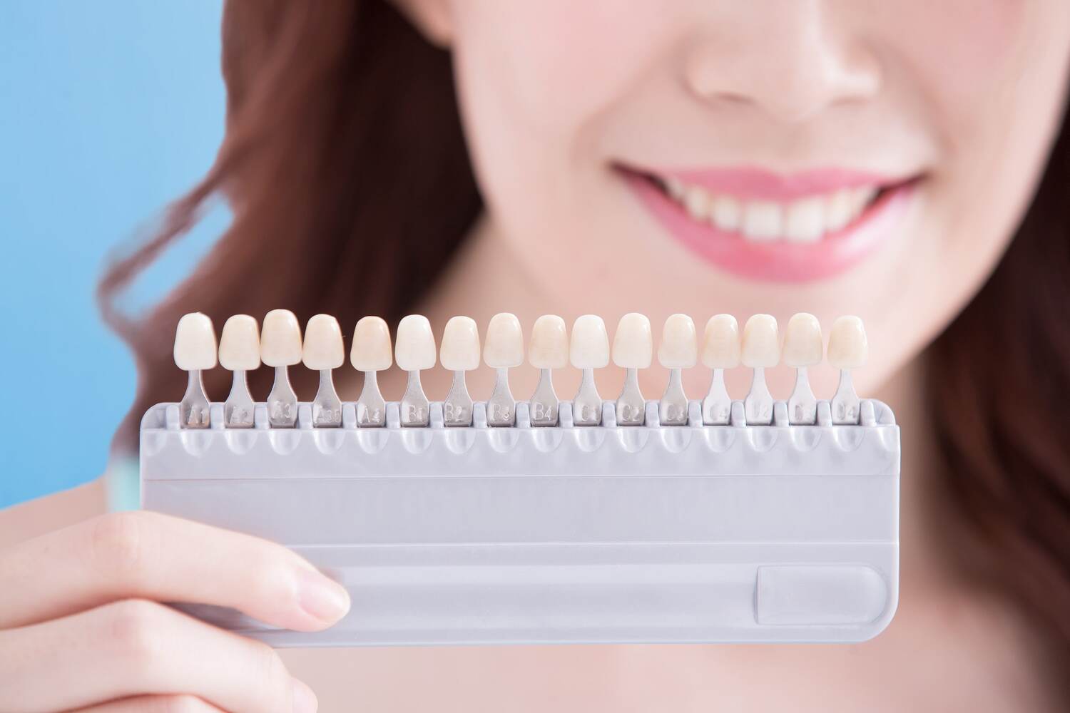 find your dream smile – with dental veneers!