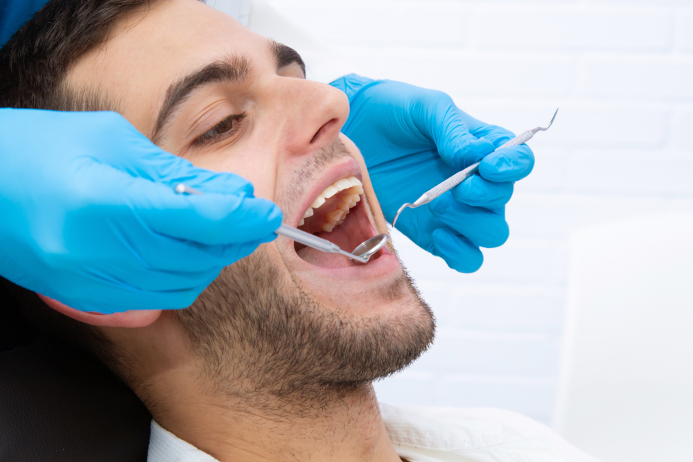 addressing common misconceptions about dental sealants