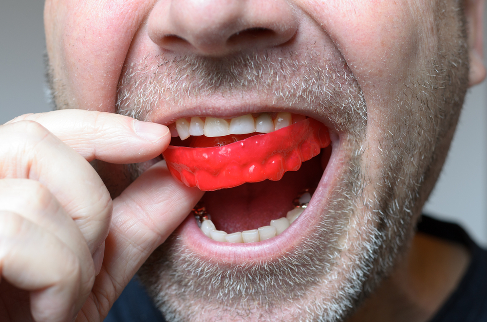 the link between tmj disorders and mouth guards
