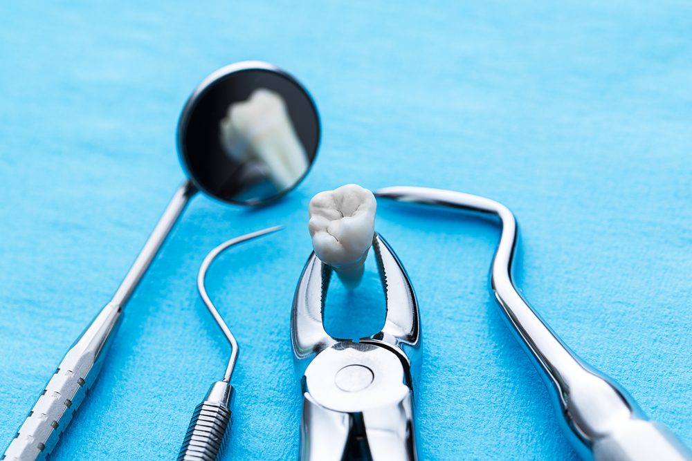 types of dental extractions simple vs surgical procedures