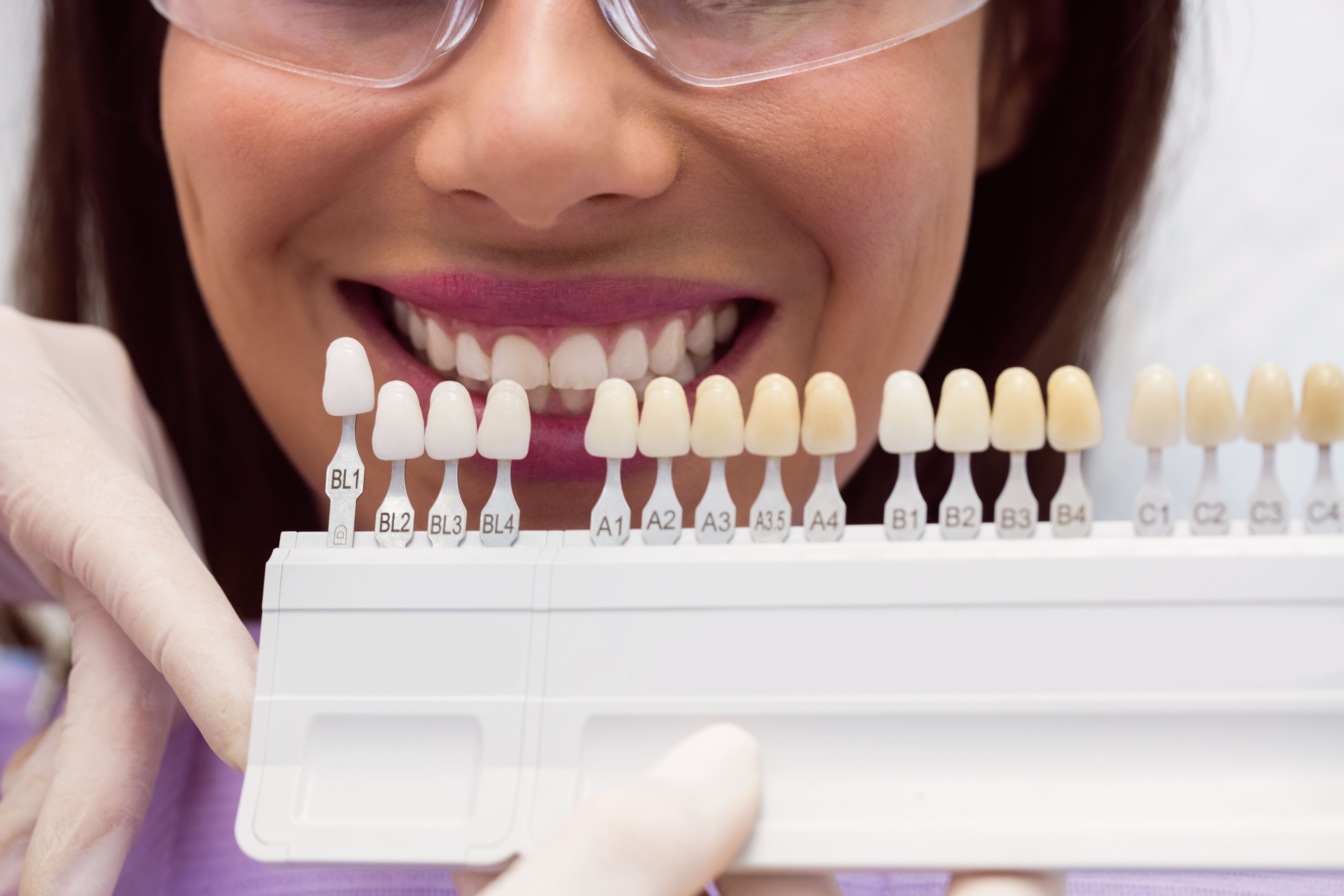 porcelain veneers sherwood park