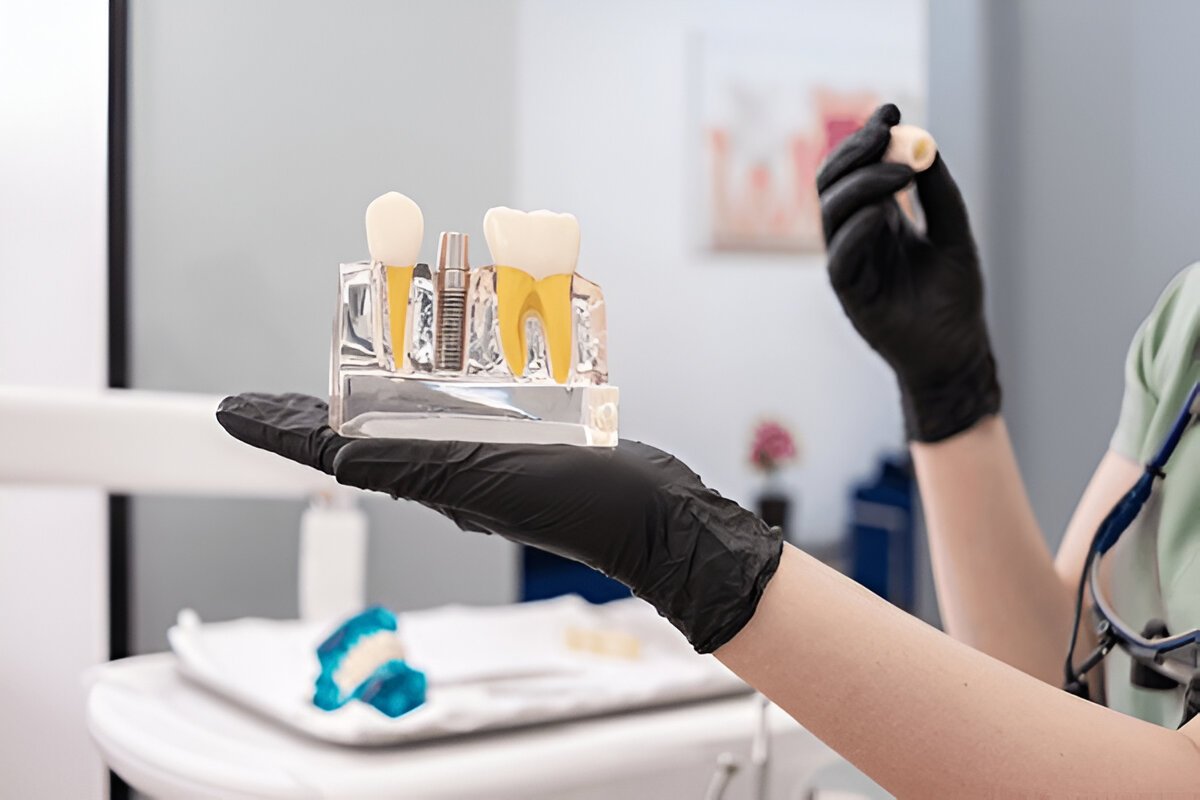 Dental Crowns in Sherwood Park